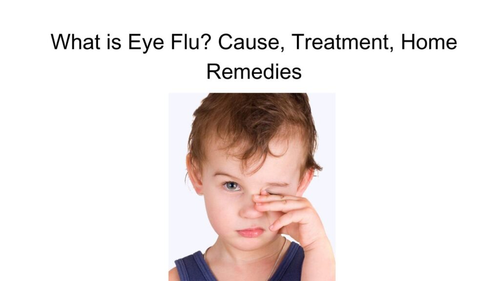 eye flu cause reason tratment