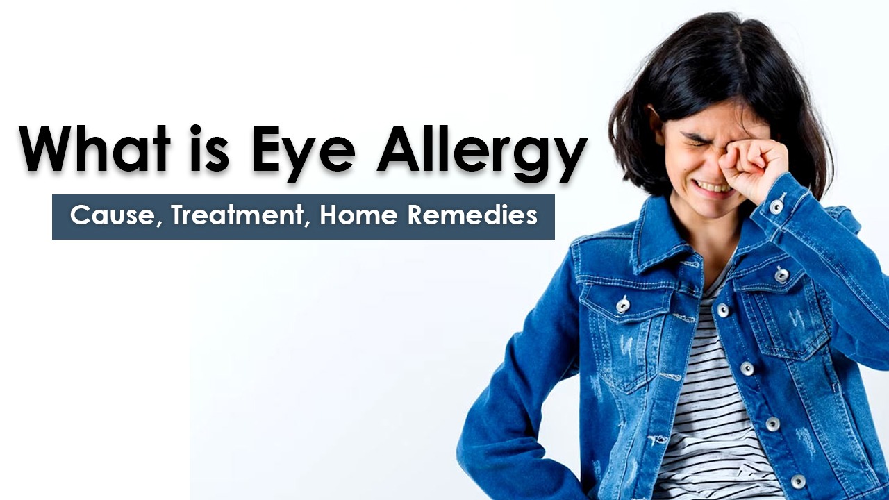 What is Eye Flu? Cause, Treatment, Home Remedies